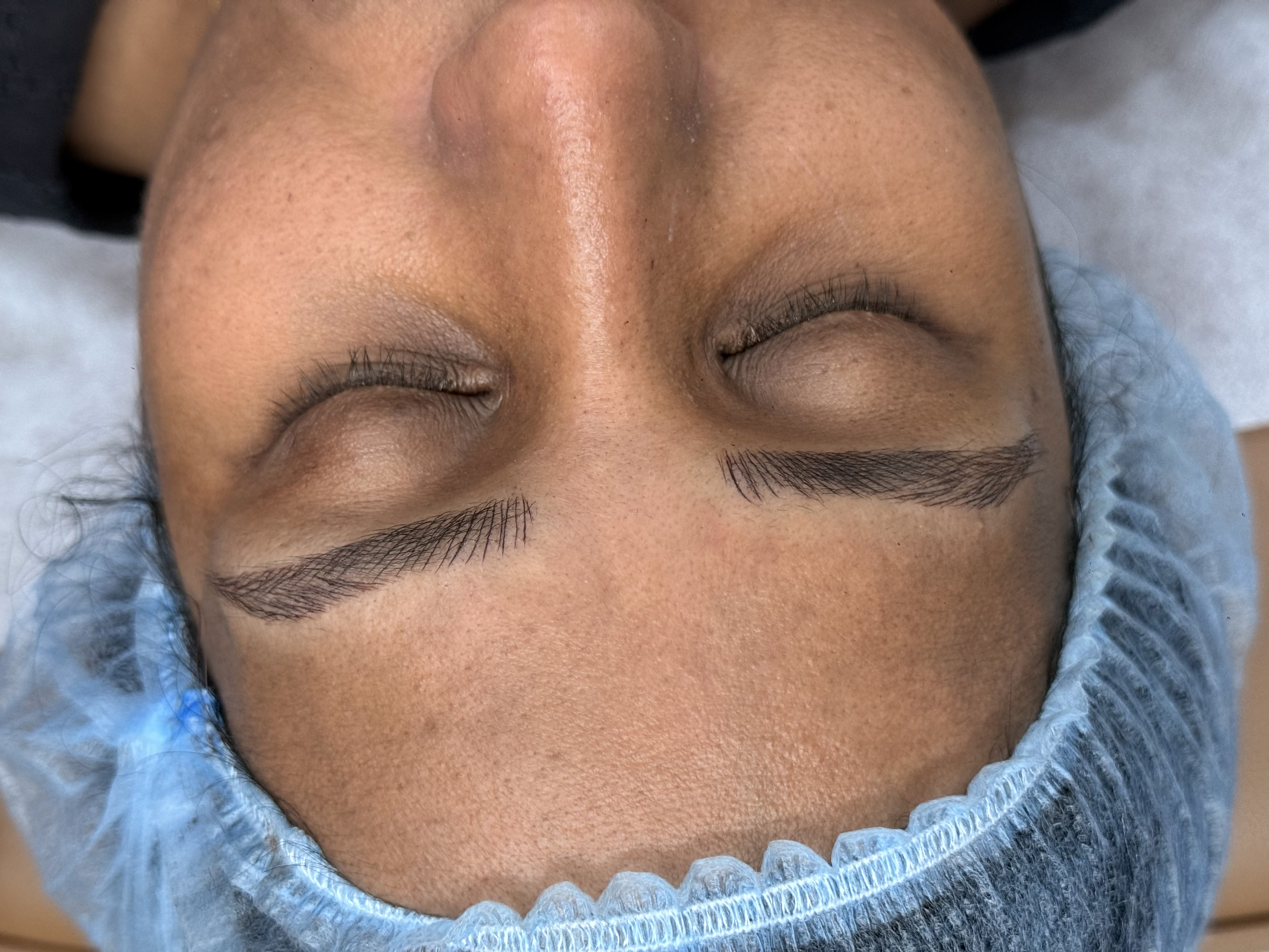 After Treatment
